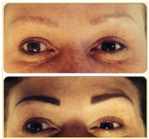 billion-dollar-brows-before-and-after-pic